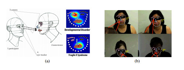斯坦福視覺實驗室最新研究：人眼移動也可以用來探測病情！？