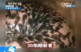 内窥镜下的烟肺惨不忍睹,戒菸后黑肺还能变白吗?