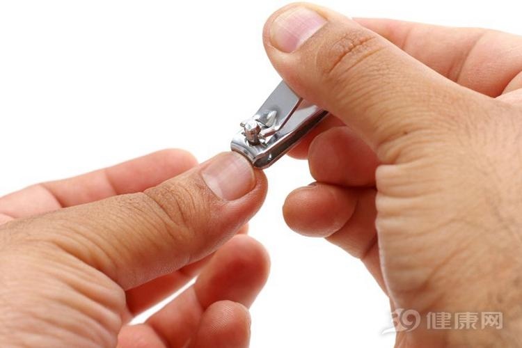 指甲上没月牙,是不是不健康?专科医生发话了